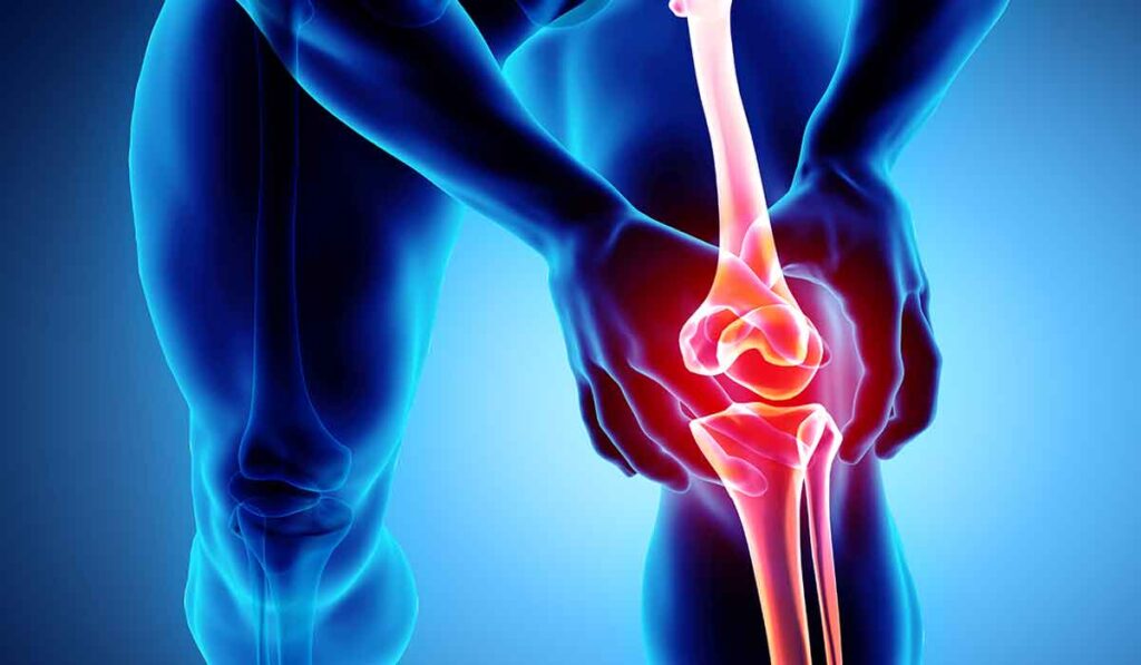 osteoarthritis